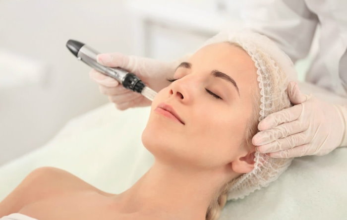 Microneedling